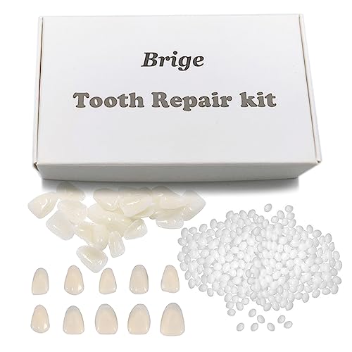 brige-temporary-tooth-repair