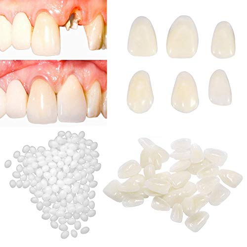 brige-tooth-repair-kit