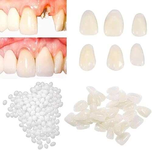 fake-tooth-repair-kits